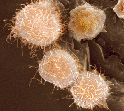 Imagen: Microfotografía electrónica de barrido a color (SEM) de células madre (Fotografía cortesía de SPL.